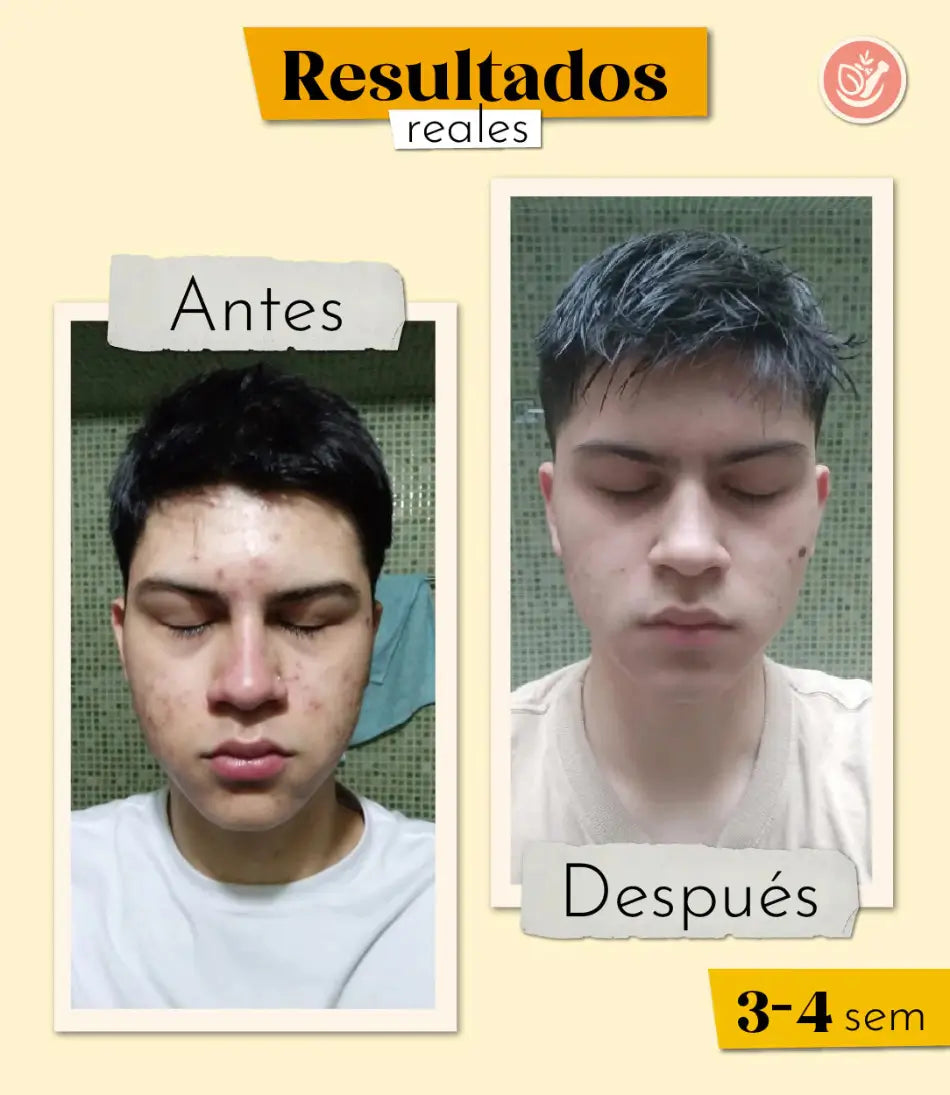 serum facial santo remedio